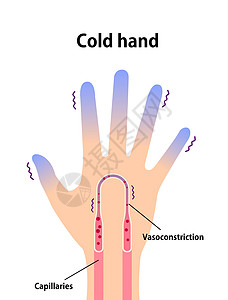冷手血液循环图示对冷指尖的敏感性器官蓝色温度插图身体寒冷卡通片寒潮手指手臂图片