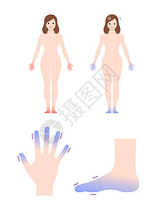 冷女人身体手脚设置血液循环插图对 col 的敏感性寒潮女士手指流感症状疾病卡通片器官状况成人图片