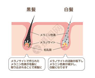 有色头发和灰色头发比较矢量图日本的机制色素沉着祖父预防白发保健压力老化发色头皮成人图片