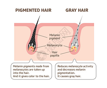 色素头发和灰色头发比较载体制作图案的机制头皮发色白发皮肤成人黑色素卫生老年色素沉着卡通片图片