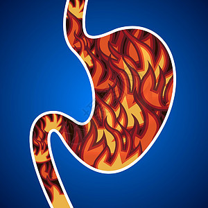 胃酸食物肠胃症状消化腹部保健疼痛消化系统药品胃炎背景图片