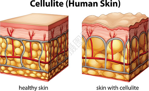 细胞素绘画毛孔血管橘皮解剖学颜料静脉科学组织插图背景图片