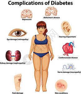 糖尿病并发症绘画损害减值重量眼睛神经心血管身体科学肥胖图片