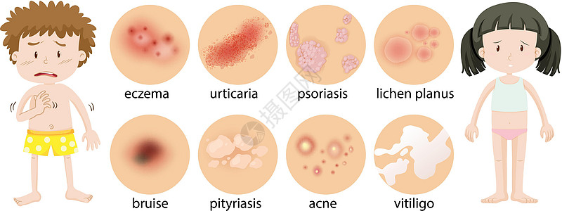 不同皮肤状况的幼儿图片