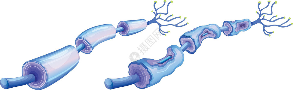 人类神经细胞和周围神经病变图片
