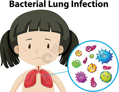 细菌性肺部传染媒介图片