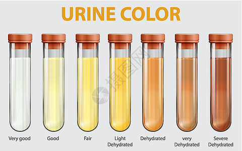 尿液色炭图解教育卡通片图表学习状况意义实验室脱水插图信息图片