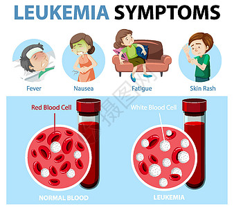 白血病症状卡通风格 infographi弱点插图细菌药品卡通片图表学习红细胞发烧医生图片