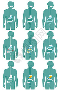 消化系统消化排腹胀溃疡器官腹痛插图疾病疼痛胃炎冒号解剖学背景图片