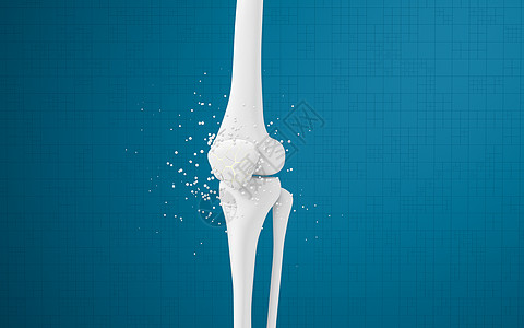 腿骨和膝盖 3D感应胫骨骨骼生物学插图外科疼痛治疗关节疾病手术图片