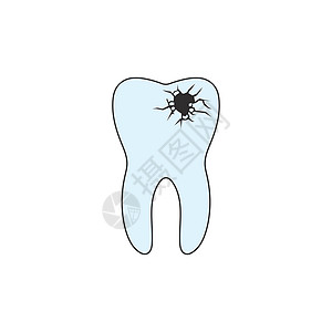 龋齿牙痛坏牙石灰石 患病的牙齿和口腔 在蓝色背景上 在白色背景上隔离的矢量图图片