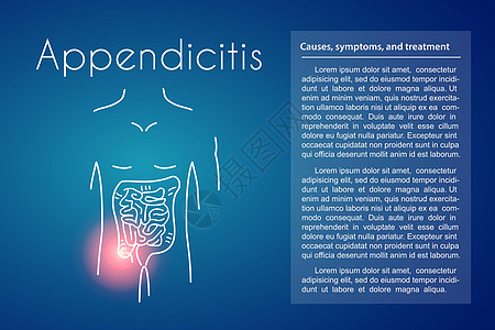 矢量阑尾炎蓝色背景图片