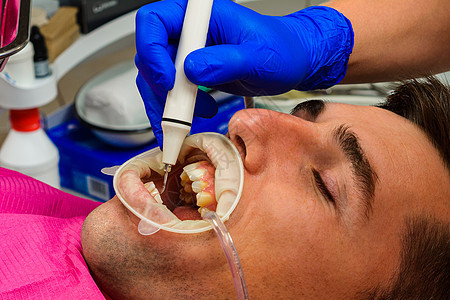 牙科实践 牙医在超声波的帮助下去除牙齿上的结石和硬斑块 患者口腔内有牵引器和唾液喷射器男人治疗口服望远镜乐器助理医生诊所病人鞑靼图片