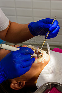 牙医用超声波检查取出牙科病人的防晒油 将嘴唇和口香糖隔离开来鞑靼治疗药品护理卫生唾液女士牙齿空腔医生图片