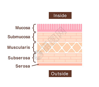 胃壁石墨衬内分区视图插图粘膜解剖学诊断浆膜侵蚀疾病溃疡身体组织胃炎图片