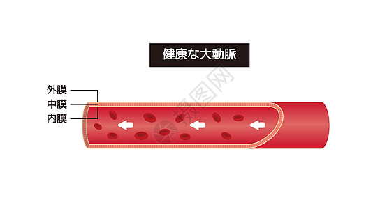 正常动脉的植被说明(日语)图片