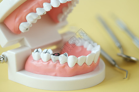 白色背景的塑料 牙齿模型专家牙科矫正治疗诊所示范假牙医生手套医疗图片