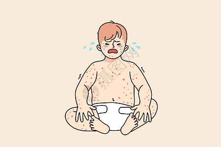 哭泣的不快婴儿患有乳疹病图片