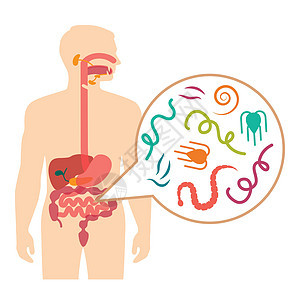 人类不试验寄生虫 蠕虫病的矢量说明蠕虫冒号疾病生物学鞭虫科学肠胃男人显微镜解剖学图片