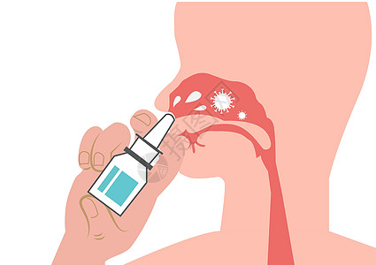 鼻洗泥土 纳萨尔盐注射 寒冷和流感季节 包括冠状病毒 平式卡通插图矢量治疗女士过敏情况医院发烧鼻音鼻子治愈生活图片