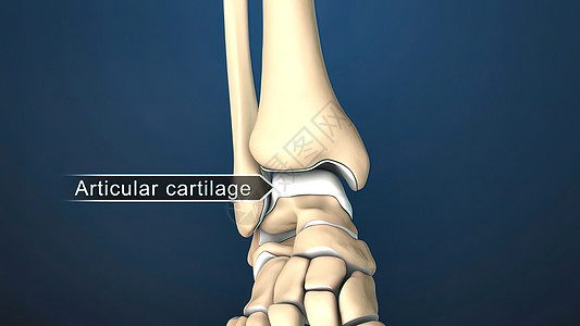 骨骼的端部是覆盖骨骼的组织组织环形老年外科大腿护膝药品老化腓骨关节镜退休图片