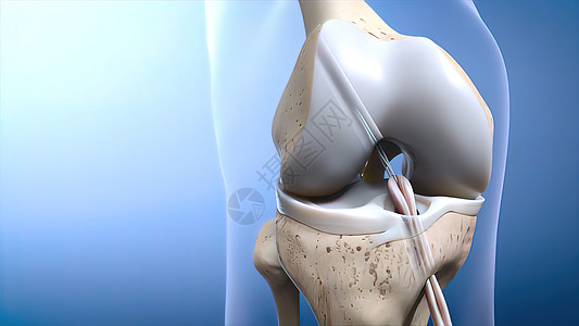 创伤或眼泪ACL护膝压力膝盖胫骨软骨解剖学药品股骨控制伤害图片
