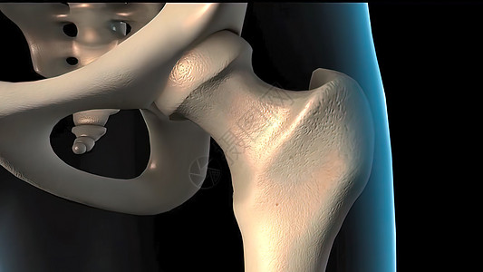 将人体骨质骨质疏松症海绵组织从正常组织发展成病人组织僵化解剖学平移衬垫骨细胞骨科康复插图股骨修理图片