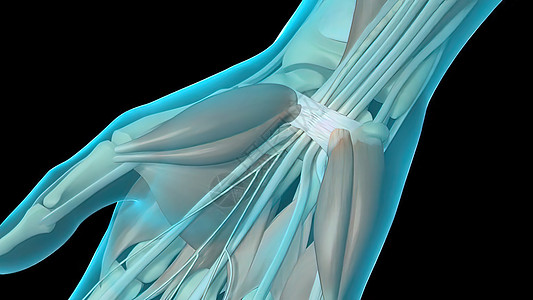 皮肤隧道综合症CTS 麻木 发痒和手腕疼痛压缩病人保健心皮神经肌腱医院解剖学手指外科图片