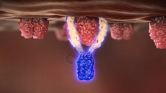 防癌细胞的抗体受体 防止癌症细胞淋巴医疗疾病倍率胰岛素计算机科学免疫学机制人体图片