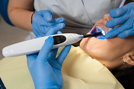 UV 光聚合物牙填充照明 牙科医生治疗和清除病人的骨灰矫正关心诊所专家牙医密封剂卫生职业治愈牙科学图片