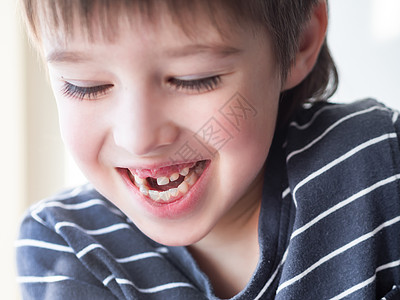 笑得不高兴的孩子嘴里有一排牙齿的洞 刚才有一个切口刀掉了出来 给牙医贴上牙套的照片图片