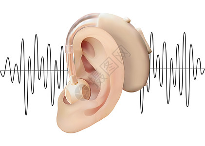 在耳后的数字式助听器 在声波图的背景上 耳鼻喉科听力损失的治疗和修复 现实的矢量图 医药卫生听觉身体器官插图调节器皮肤衬垫方法假背景图片
