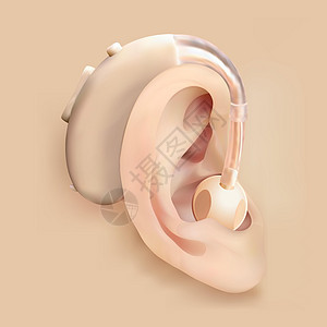 耳后助听器 耳朵和声音放大器 耳聋和听力损失 耳鼻喉科的治疗和修复学 医药卫生 现实的对象 向量图片