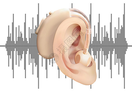 在耳后的数字式助听器 在声波图的背景上 耳鼻喉科听力损失的治疗和修复 现实的矢量图 医药卫生调节器工具方法模拟药品助听器耳聋喷嘴图片