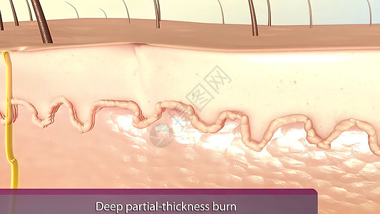 从深处到地表 可以辨别出巴萨勒 脊髓 颗粒和角膜层的薄皮显微蒸腾植物颜料静脉叶子气孔细胞上皮组织图片