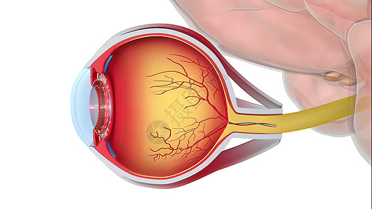 Glaucoma是一种眼睛状况 它损害光神经 对良好的视力至关重要眼科卫生镜片手表瞳孔静脉青光眼解剖学乐器光学图片