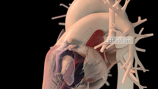 人类心脏 现实的解剖静脉病人中庭节点男人伤害起搏器心肌疼痛心脏病图片