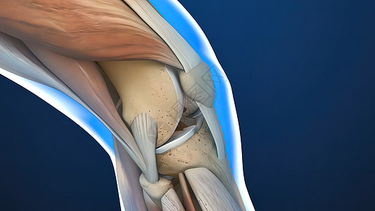 膝腿骨解剖关节髌骨成人药品访问护膝大腿退休手术老年图片
