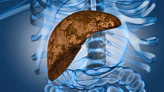 肝病的进化 肝衰竭解剖学外科科学攻击身体脂肪酸细胞手术生物学肝硬化图片