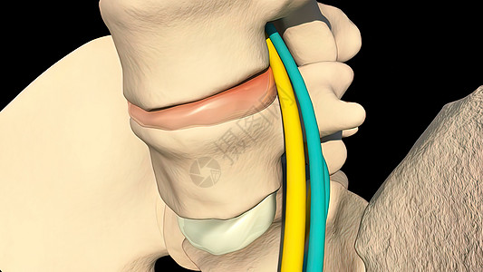 静脉炎症发炎椎骨骨干联合外科骨骼股骨生物学身体散热腰椎图片