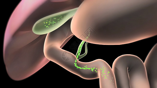 活性 潘克里亚和盖球形条件治疗肝硬化男性攻击痛苦脂肪酸图表黄疸癌症疼痛图片
