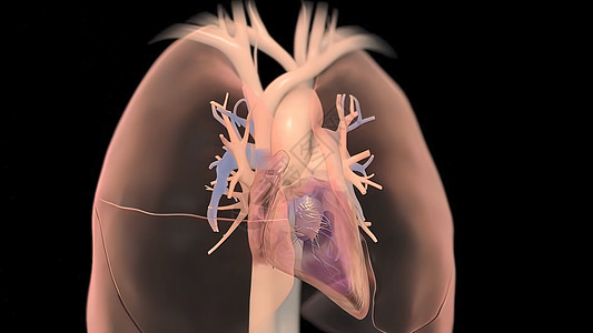 人类心脏 现实的解剖主动脉动脉阀门肌肉伤害解剖学发烧中庭病人心室图片
