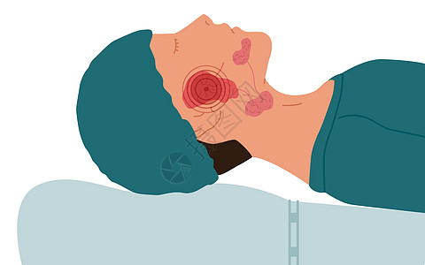 腰椎管狭窄症患有病原性口腔炎的病人 用矢量说明西雅洛叶丝虫病插画