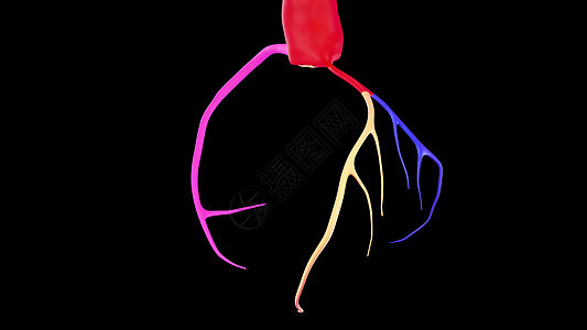 CTA 代心动脉3D 72020心脏病临床解剖学动脉插图心脏病学心律失常血管心电图心血管图片