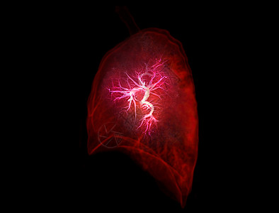 CT切斯特或肺3D的选择性重点 为诊断肺病 肺结核或结核病和共生19提供图像横向观察图片
