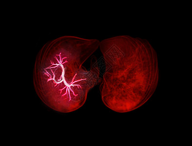 CT切斯特或肺3D的选择性重点 为诊断肺病 肺结核或结核病及食堂19提供图像外观图片