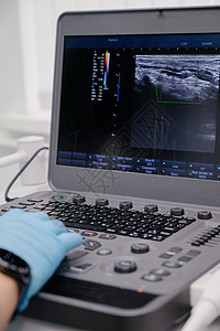 医生使用超声波设备研究静脉的状况 现代超声波监视器考试病痛扫描器诊断药品药物心血管检查形成血管图片