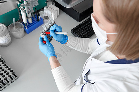 实验室技术员用红标记笔在一些样品上打标背景图片