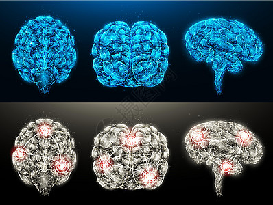 健康大脑和有炎症病灶的患病大脑的多边形矢量插图集 神经系统医学横幅 模板或背景图片