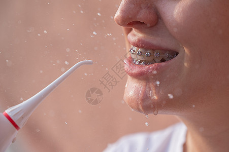 牙齿上有牙套的女人用的是喷水器 近身肖像微笑打扫牙刷卫生治疗配饰牙线喷射口服裁剪图片